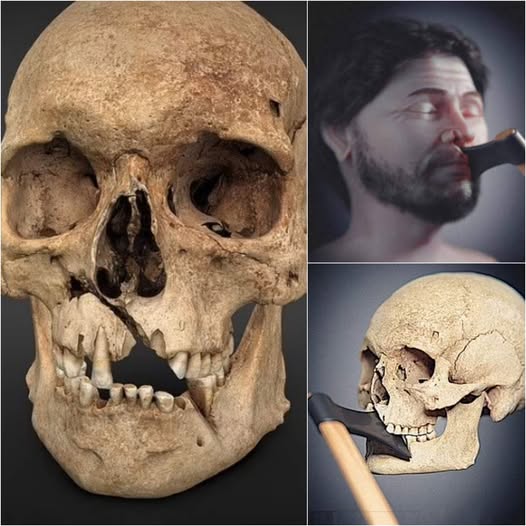 Unveiling the Past: See the Reconstructed Face of a 14th-Century Warrior Who Battled Until His Last Breath in 1361!