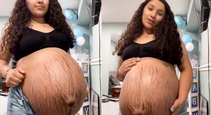 Woman’s Bump Is So Big 😢People Are Convinced She Has More Than Two In There