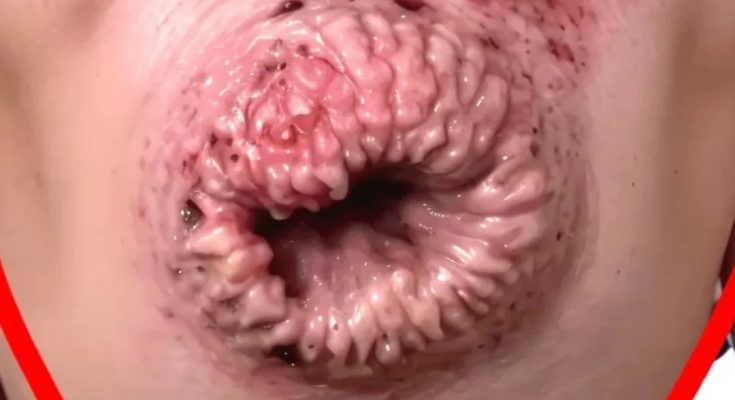 Changes in the Face That Indicate Serious Health Issuess