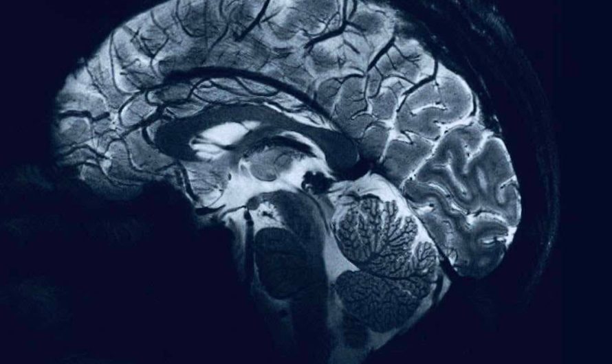 Neurologist reveals the scariest thing people do to their brains