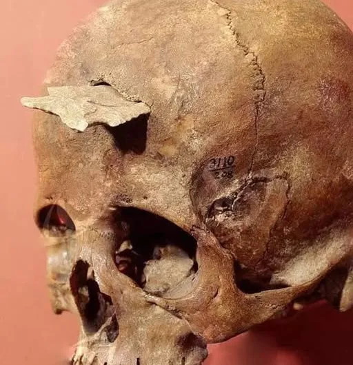 The Anasazi Woman’s Skull: A Haunting Tale from Mesa Verde