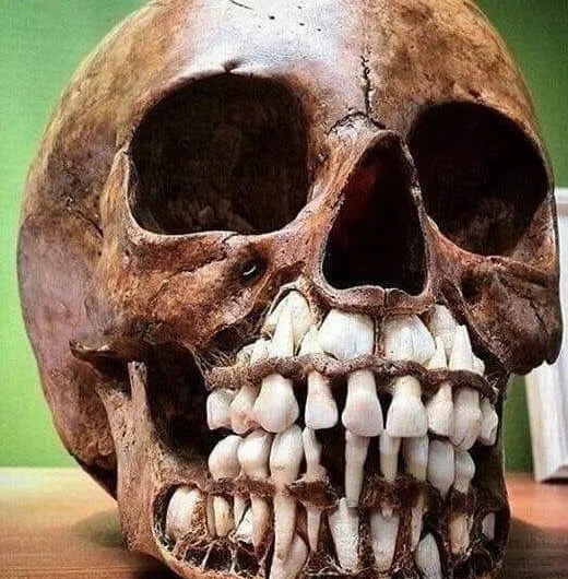 Gnarly X-rays show what really happens when baby teeth fall out of child’s skull