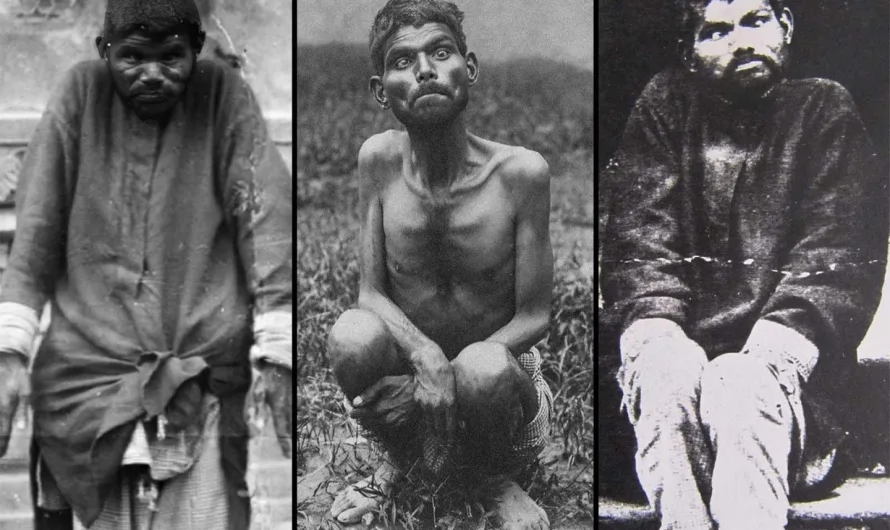 Dina Sanichar: The Real-Life Feral Boy Raised by Wolves Who May Have Inspired ‘The Jungle Book’