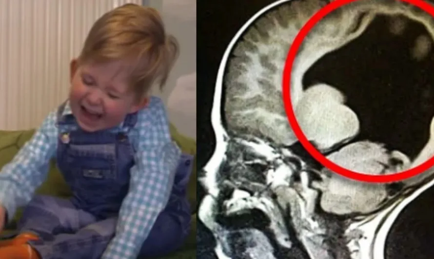 Weird News: He’s extraordinary! Baby boy born without brain [VIDEO]