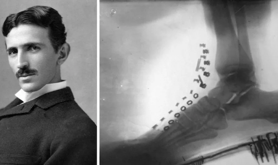 Nikola Tesla Made an X-Ray of His Own Foot With a Machine He Designed in 1896