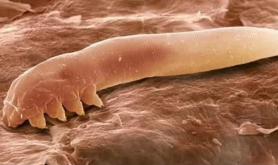 While you sleep, these bugs throw a party on your face