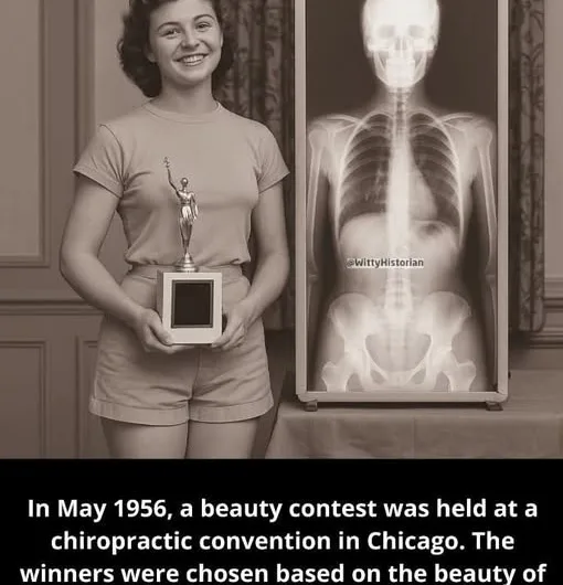 When the Perfect Spine Was Crowned: The Bizarre Tale of the 1956 “Mr. and Miss Lovely Vertebra” Contest