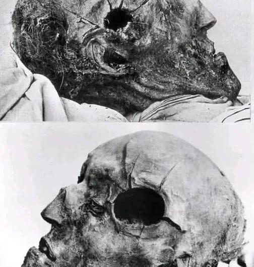 The Mysterious Death of Sweden’s Warrior King: Charles XII and the Shot at Fredriksten