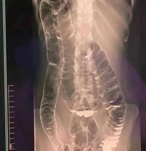 The Day My Body Charged Me Interest: A True Story That Almost Killed Me