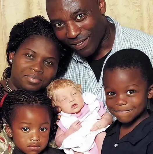 The Rare Genetics Behind the White Baby Born to Black Nigerian Parents in London