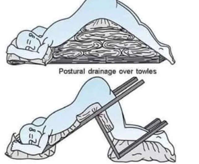 The Nursing Home That Defeated Influenza with Towels