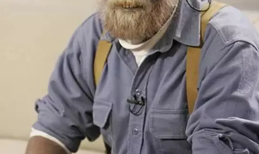 Bizarre ‘Papa Smurf’ resurfaces on the internet; know how overuse of colloidal silver caused a man to turn blue