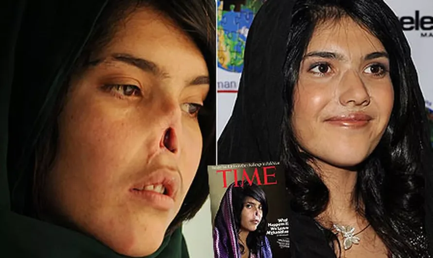 Bibi Aisha bravely shows her new face after Taliban cut off her nose and ears